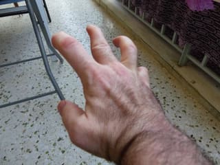 Amea (90%) Ζητάει Πλήκτρα